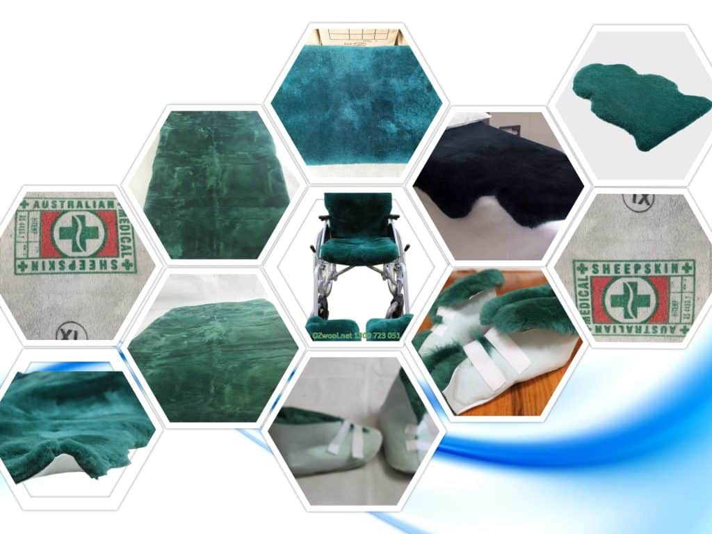 Medical Sheepskins are natural products that are used to prevent and deal with bedsores, pressure sores and decubitus ulcers. Medical sheepskin handles the pain and secures those confined to bed. There are 3 grades of Australian Medical sheepskins.
