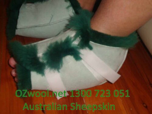 Ozwool High Temperature Washable Medical Heel Guards 1 Scaled 1 - Extra Large Heel Cuff - Ozwool.com.au Australian Sheepskin Products
